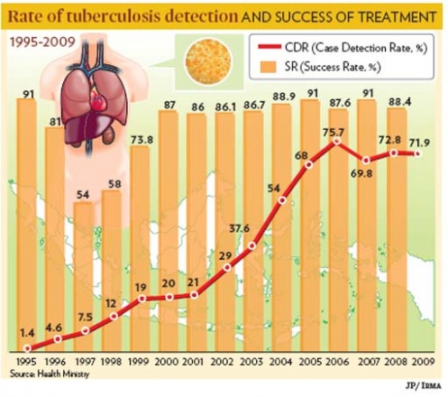 tuberculosis