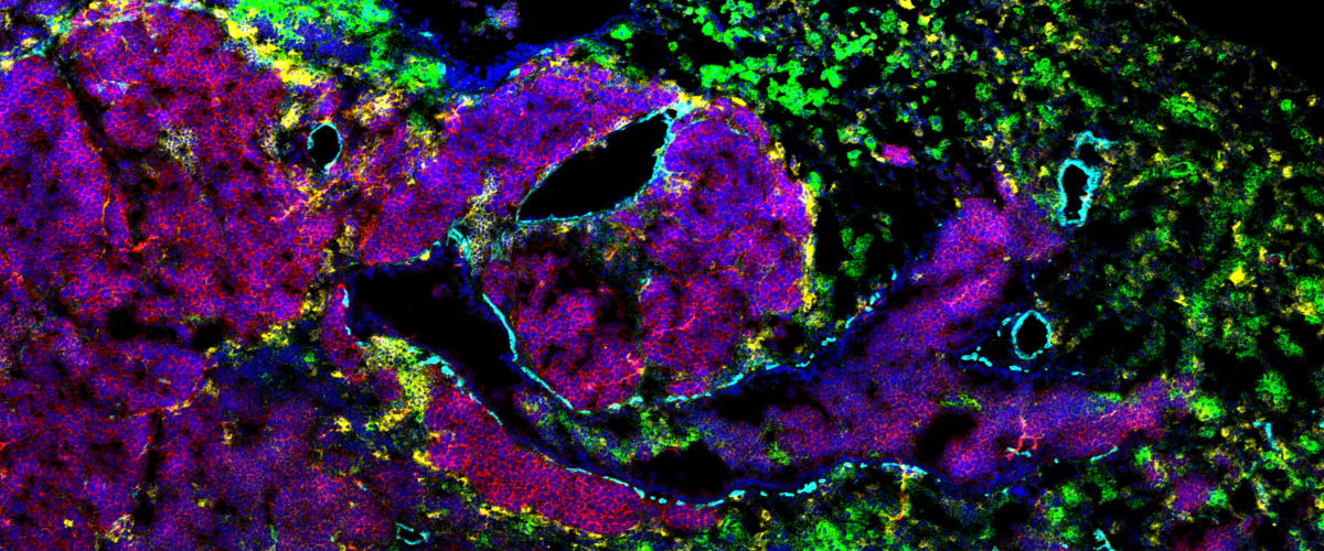 small cell lung cancer mouse tissue